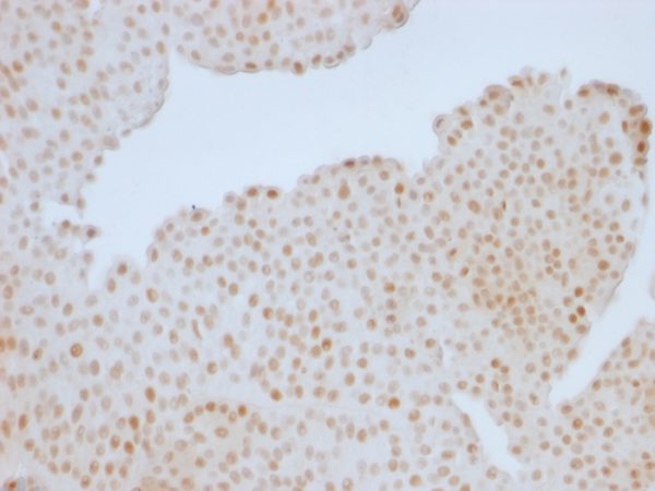 Formalin-fixed, paraffin-embedded human Colon stained with Retinoblastoma (Rb1) Monoclonal Antibody (RB1/1754).