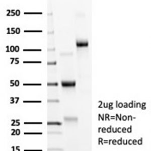 SDS-PAGE Analysis Purified ACE2 / CD143 Rabbit Monoclonal Antibody (ACE2/6788R). Confirmation of Integrity and Purity of Antibody.