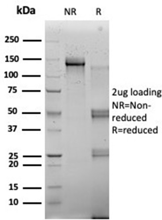 SDS-PAGE Analysis of Purified RBMS2 Mouse Monoclonal Antibody (PCRP-RBMS2-1B6). Confirmation of Integrity and Purity of Antibody.