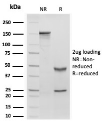 SDS-PAGE Analysis of Purified RBP1 Recombinant Mouse Monoclonal Antibody (rRBP1/872). Confirmation of Purity and Integrity of Antibody.