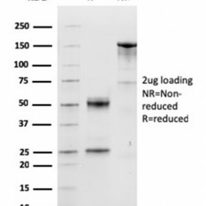 SDS-PAGE Analysis of Purified Cyclin D1 Mouse Monoclonal Antibody (CCND1/3548). Confirmation of Purity and Integrity of Antibody.