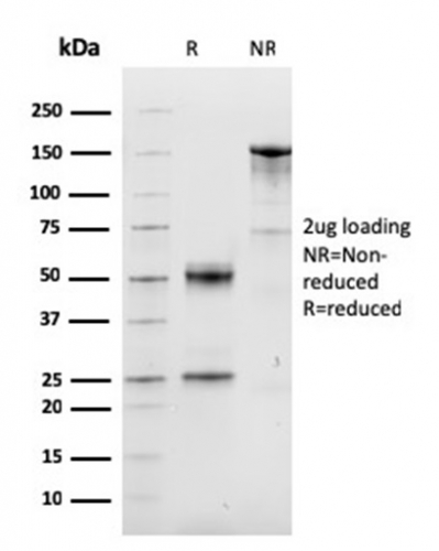 SDS-PAGE Analysis of Purified Cyclin D1 Mouse Monoclonal Antibody (CCND1/3548). Confirmation of Purity and Integrity of Antibody.
