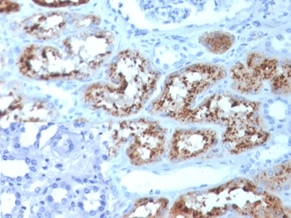 Formalin-fixed, paraffin-embedded human kidney stained with RBP4 Mouse Monoclonal Antibody (RBP4/4051). Inset: PBS was used instead of the primary antibody as the negative control.