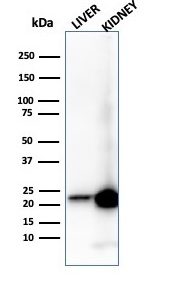Western blot analysis of human kidney and liver tissue lysates using RBP4 Mouse Monoclonal Antibody (RBP4/4314).