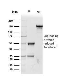 SDS-PAGE Analysis of Purified RBP4 Mouse Monoclonal Antibody (RBP4/4042) Confirmation of Purity and Integrity of Antibody.