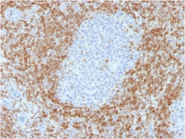 Formalin-fixed, paraffin-embedded human tonsilstained with Bcl-2 Mouse Recombinant Monoclonal Antibody (rBCL2/782).