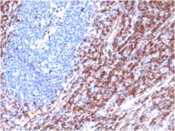 Formalin-fixed, paraffin-embedded human tonsilstained with Bcl-2 Mouse Recombinant Monoclonal Antibody (rBCL2/6418).