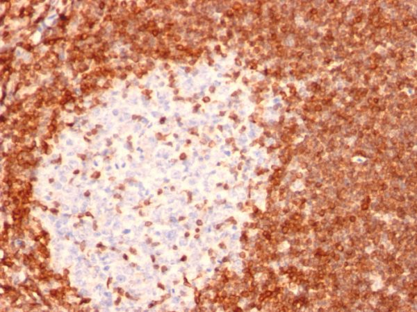 Formalin-fixed, paraffin-embedded human tonsil stained with Bcl-2 Mouse Monoclonal Antibody (8C8).