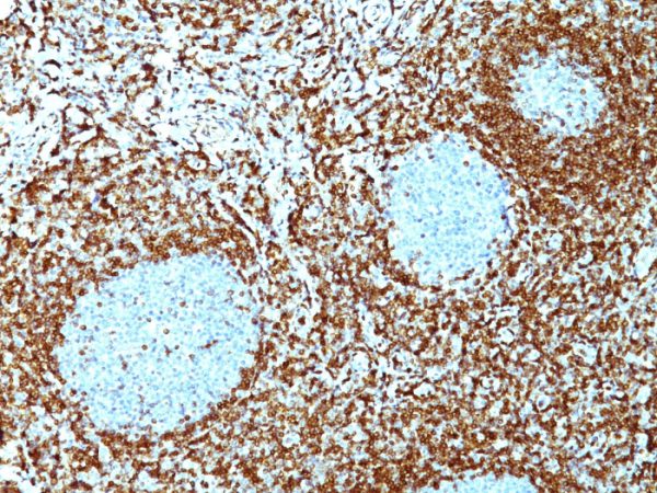 Formalin-fixed, paraffin-embedded human tonsil stained with Bcl-2 Mouse Monoclonal Antibody (124).