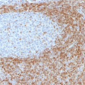Formalin-fixed, paraffin-embedded tonsil stained with Bcl-2 Mouse Monoclonal Antibody (SPM530).