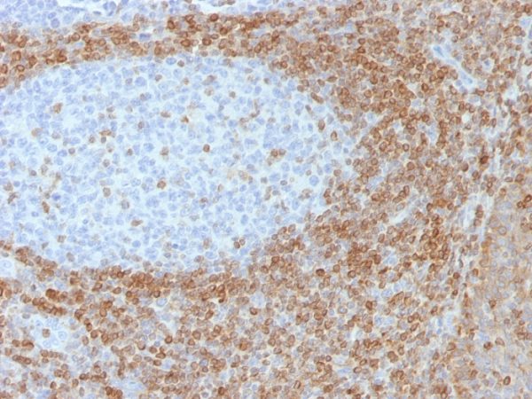 Formalin-fixed, paraffin-embedded tonsil stained with Bcl-2 Mouse Monoclonal Antibody (SPM530).