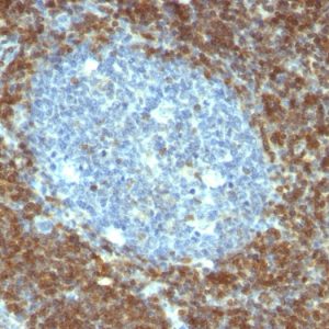 Formalin-fixed, paraffin-embedded human Tonsil stained with Bcl-2 Mouse Monoclonal Antibody (BCL2/796).