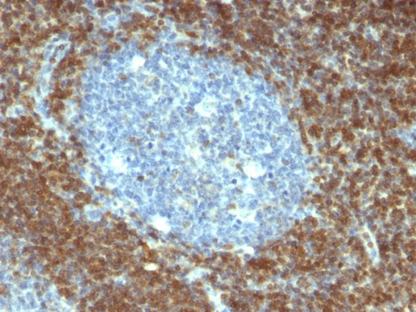 Formalin-fixed, paraffin-embedded human Tonsil stained with Bcl-2 Mouse Monoclonal Antibody (BCL2/796).