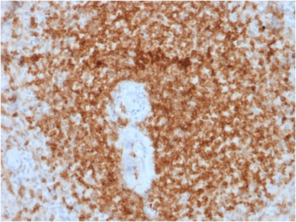Formalin-fixed, paraffin-embedded human Spleen stained with Bcl-2 Mouse Recombinant Monoclonal Antibody (rBCL2/796).