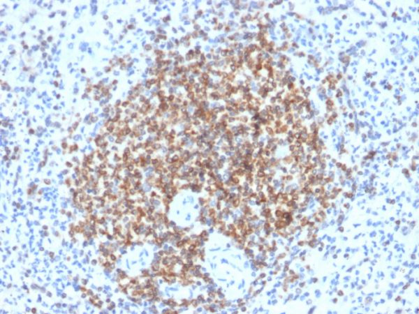 Formalin-fixed, paraffin-embedded human spleen stained with Bcl-2 Rabbit Recombinant Monoclonal Antibody (BCL2/2210R).