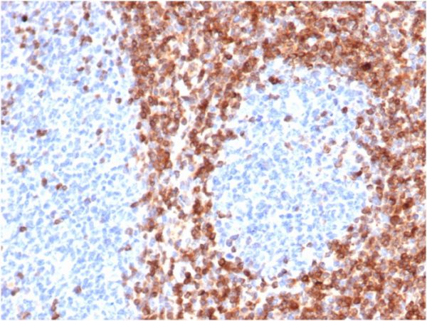 Formalin-fixed, paraffin-embeddedhuman tonsilstained with Bcl-2 Rabbit Recombinant Monoclonal Antibody (BCL2/6426R).