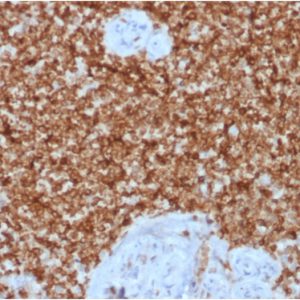 Formalin-fixed, paraffin-embeddedhuman spleen stained with Bcl-2 Rabbit Recombinant Monoclonal Antibody (BCL2/1878R).