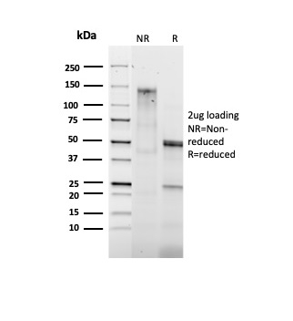 SDS-PAGE Analysis Purified Bcl-2 Rabbit Recombinant Monoclonal Antibody (BCL2/1878R). Confirmation of Purity and Integrity of Antibody.