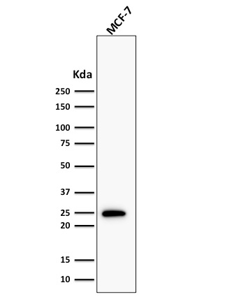 Western blot analysis of human MCF-7 cell lysate using Bcl-2 Rabbit Recombinant Monoclonal Antibody (BCL2/1878R).