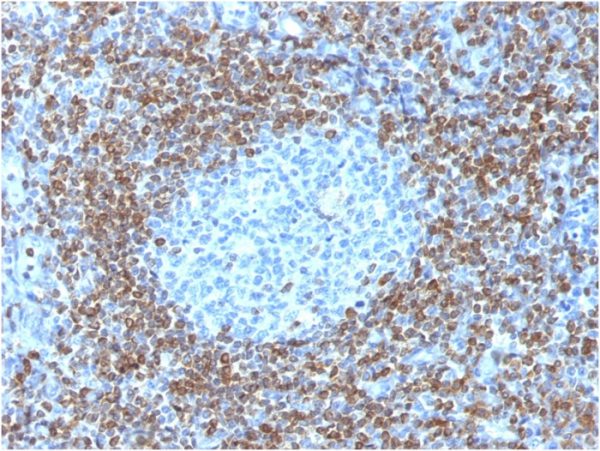 Formalin-fixed, paraffin-embedded human tonsil stained with Bcl-2 Rabbit Recombinant Monoclonal Antibody (BCL2/1878R).