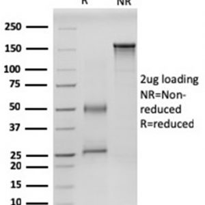 SDS-PAGE Analysis of Purified RET-Monospecific Mouse Monoclonal Antibody (RET/2599). Confirmation of Integrity and Purity of Antibody