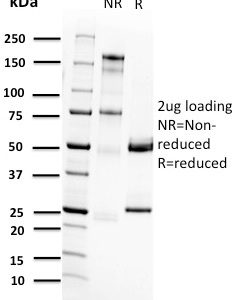 SDS-PAGE Analysis of Purified RET Mouse Monoclonal Antibody (RET/2662). Confirmation of Purity and Integrity of Antibody.