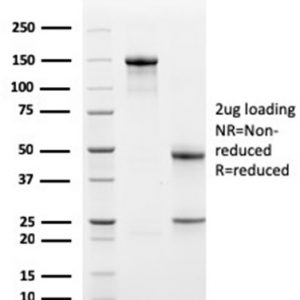 SDS-PAGE Analysis of Purified Bcl-x Mouse Monoclonal Antibody (BCL2L1/1762). Confirmation of Purity and Integrity of Antibody.