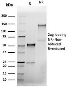 SDS-PAGE Analysis of Purified Bcl-x Recombinant Mouse Monoclonal Antibody (rBCL2L1/4508). Confirmation of Purity and Integrity of Antibody.
