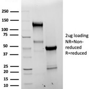 SDS-PAGE Analysis of Purified Bcl-x Recombinant Rabbit Monoclonal Antibody (BCL2L1/4509R). Confirmation of Purity and Integrity of Antibody.