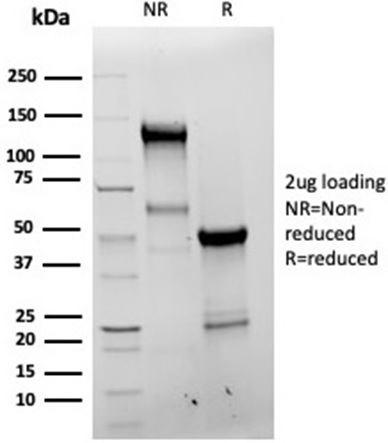 SDS-PAGE Analysis Purified Bcl-x Recombinant Rabbit Monoclonal Antibody (BCL2L1/4509R). Confirmation of Purity and Integrity of Antibody.