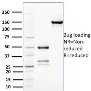 SDS-PAGE Analysis of Purified BCL2L2 Mouse Monoclonal Antibody (CPTC-BCL2L2-2). Confirmation of Purity and Integrity of Antibody.