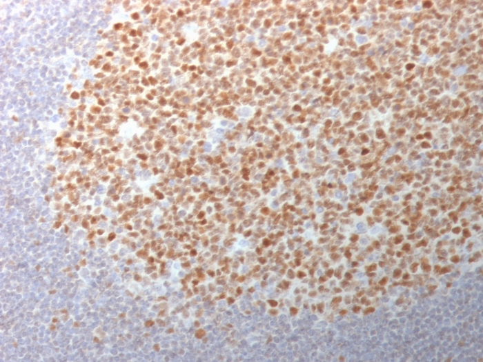 Formalin-fixed, paraffin-embedded human Tonsil stained with BCL-6 Mouse Monoclonal Antibody (BCL6/1982). Bcl-6 (Follicular Lymphoma Marker) Antibody