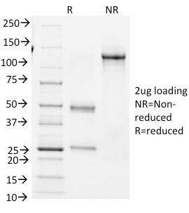 SDS-PAGE Analysis of Purified BCL-6 Mouse Monoclonal Antibody (BCL6/1982). Confirmation of Integrity and Purity of Antibody. Bcl-6 (Follicular Lymphoma Marker) Antibody - Image 2