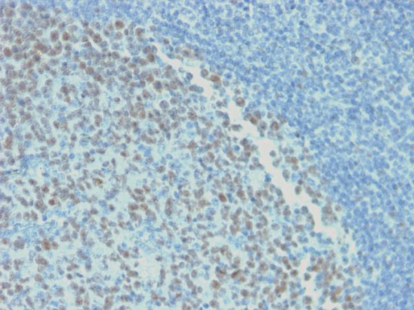 Formalin-fixed, paraffin-embedded human Tonsil stained with BCL-6 Mouse Recombinant Monoclonal Antibody (rBCL6/1718).
