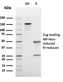 SDS-PAGE Analysis of Purified bcl-6 Recombinant Mouse Monoclonal Antibody (rBCL6/1475). Confirmation of Purity and Integrity of Antibody.