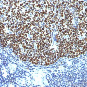 Formalin-fixed, paraffin-embedded human Tonsil stained with bcl-6 Monoclonal Antibody (SPM602).