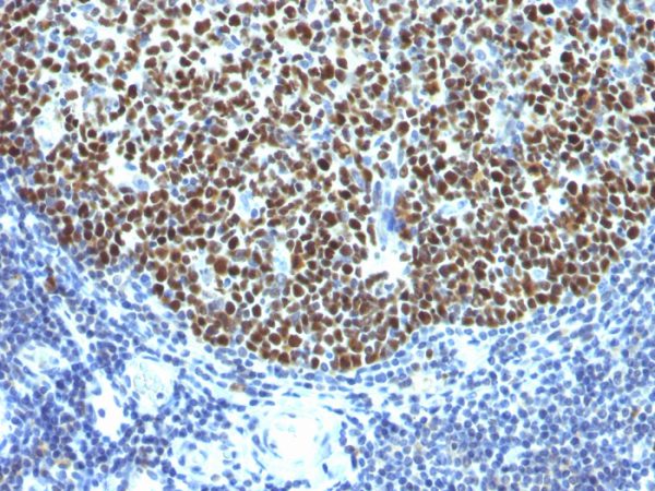 Formalin-fixed, paraffin-embedded human Tonsil stained with bcl-6 Monoclonal Antibody (SPM602).