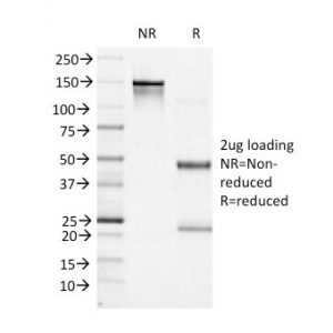 SDS-PAGE Analysis of Purified BCL-6 Mouse Monoclonal Antibody (BCL6/1527). Confirmation of Integrity and Purity of Antibody.