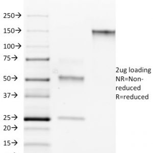 SDS-PAGE Analysis of Purified ROR-gamma / RORC Mouse Monoclonal Antibody (RORC/2942). Confirmation of Purity and Integrity of Antibody.