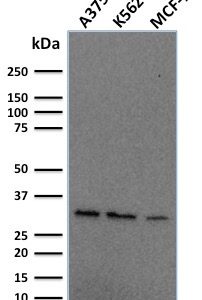 Western blot analysis of human A375, K562 & MCF-7 cell lysates using Replication Protein A2 Mouse Monoclonal Antibody (RPA2/2106).