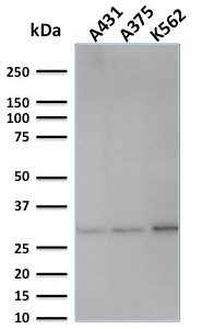 Western blot analysis of human A431, A375 and K562 cell lysates using Replication Protein A2 Mouse Monoclonal Antibody (SPM316).