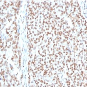 Formalin-fixed, paraffin-embedded human colon stained with RPA2 Mouse Monoclonal Antibody (RPA2/4774).