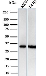 Western blot analysis of human MCF-7 & T47D cell lysates using RPA2 Recombinant Rabbit Monoclonal Antibody (RPA2/3140R).