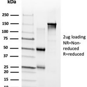SDS-PAGE Analysis Purified ZNF704 Mouse Monoclonal Antibody (PCRP-ZNF704-3C10). Confirmation of Integrity and Purity of Antibody.