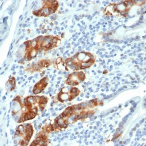 Formalin-fixed, paraffin-embedded human small intestine stained with RRM1 Recombinant Rabbit Monoclonal (RRM1/4372R).