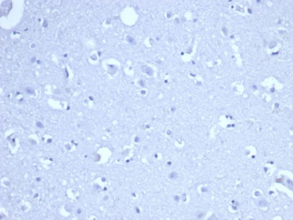 IHC analysis of formalin-fixed, paraffin-embedded human brain. Negative tissue control using RRM1/4372R at 2ug/ml in PBS for 30min RT. HIER: Tris/EDTA, pH9.0, 45min. 2 °: HRP-polymer, 30min. DAB, 5min.