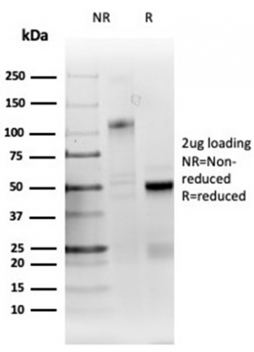 SDS-PAGE Analysis Purified RRM1 Recombinant Rabbit Monoclonal (RRM1/4372R). Confirmation of Purity and Integrity of Antibody.
