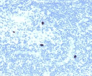 Formalin-fixed, paraffin-embedded human lymph node stained with RXRB Mouse Monoclonal Antibody (PCRP-RXRB-2B6).