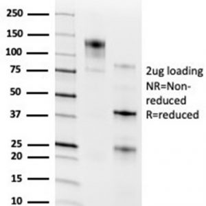 SDS-PAGE Analysis of Purified RXRG Mouse Monoclonal Antibody (PCRP-RXRG-5H4). Confirmation of Integrity and Purity of Antibody.