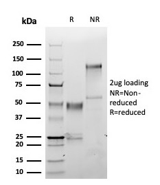 SDS PAGE Analysis Purified S100A1 Rabbit Monoclonal Antibody (S100A1/6374R) Confirmation of Purity and Integrity of Antibody.